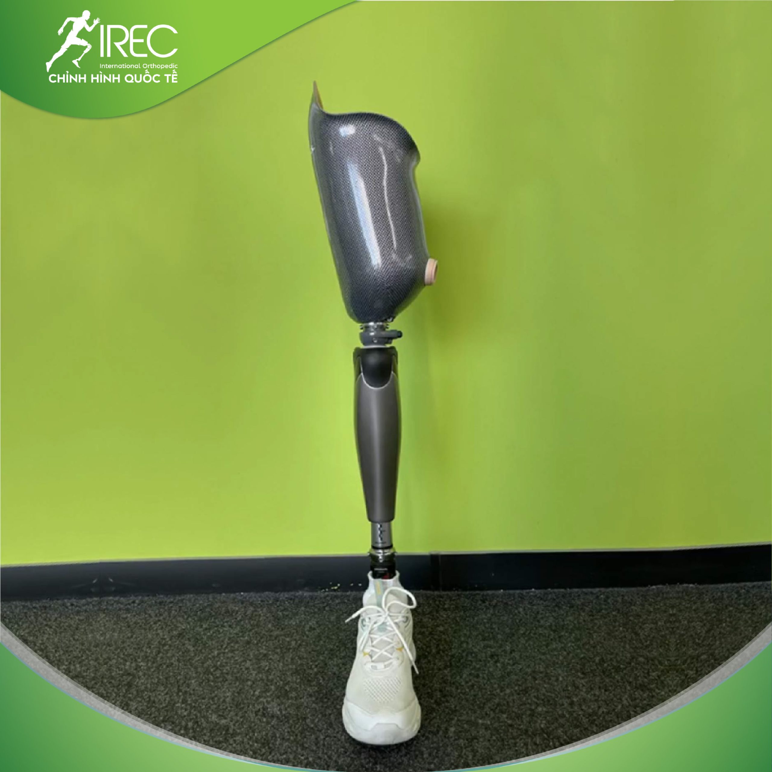 các loại chân giả trên gối