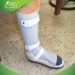 nẹp bàn chân khi đi giày