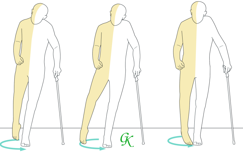 Phục hồi chức năng là gì
