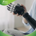 tay giả chức năng điện