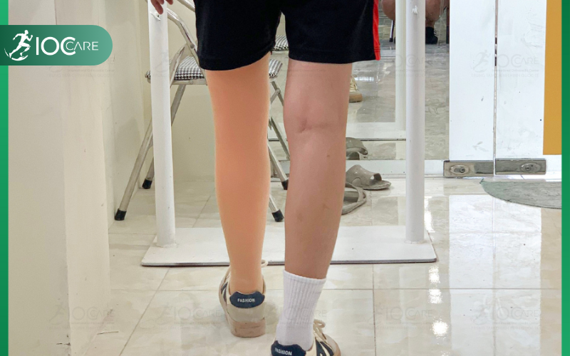 Chân giả trên gối bị lỏng