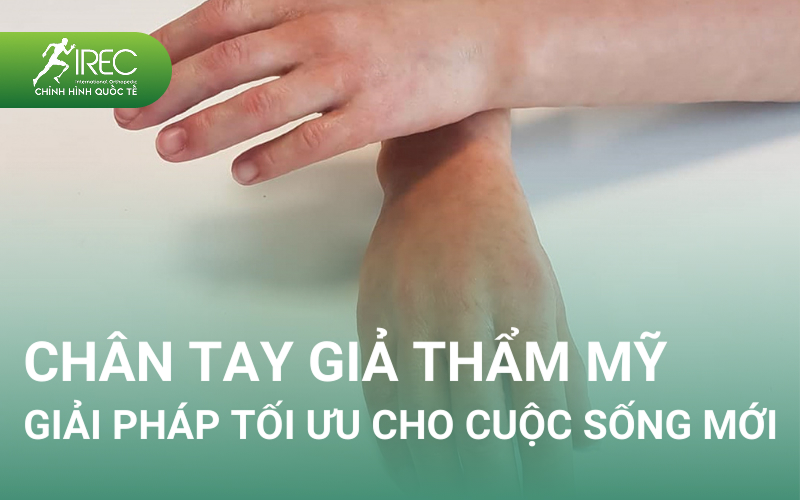 tư vấn bàn tay giả