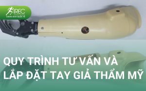 các loại cánh tay giả