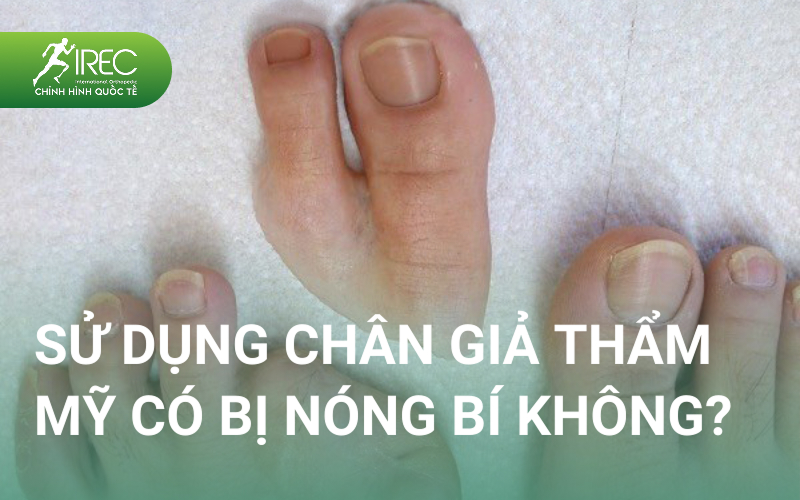 Cách chọn chân giả silicon