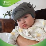 MŨ CHỈNH HÌNH 3D
