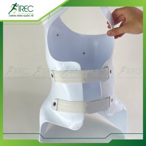 thời gian đeo nẹp chỉnh vẹo cột sống