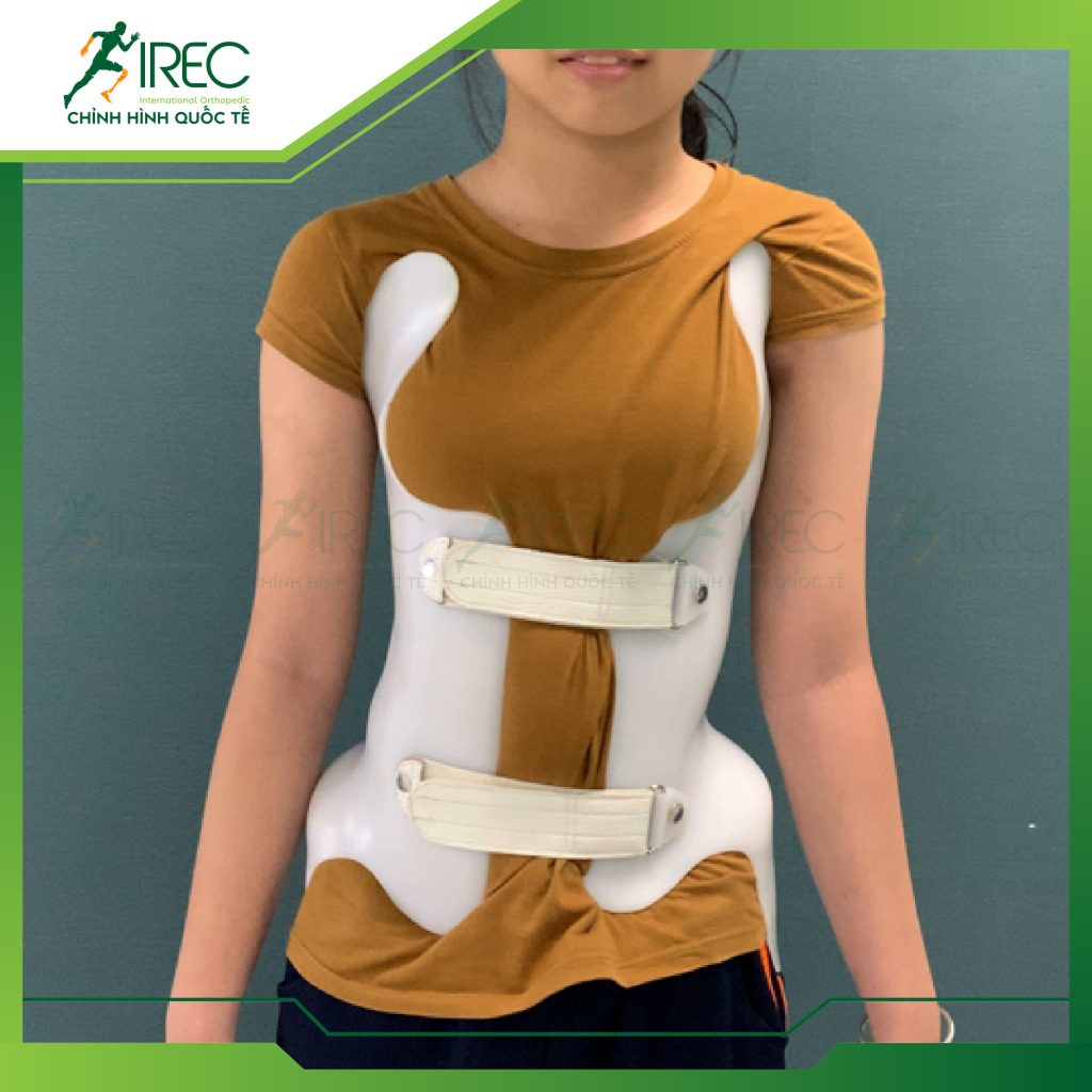 áo cong vẹo cột sống