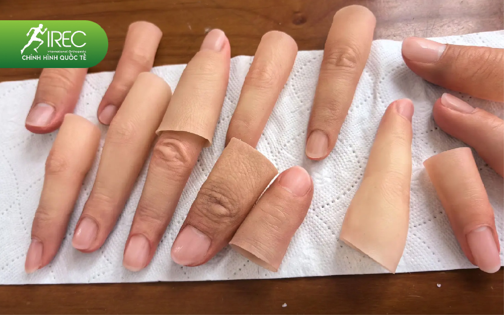 Địa chỉ làm ngón tay giả