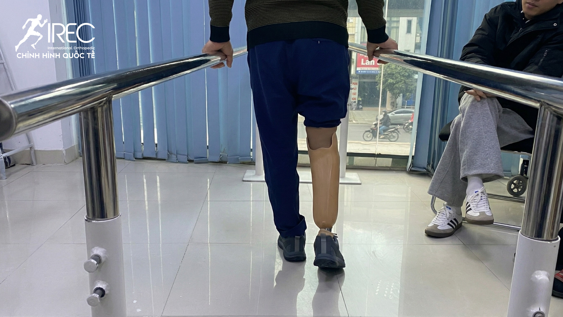 chân giả cho người khuyết tật, chân giả dưới gối