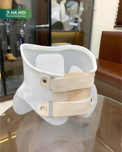 hình ảnh nẹp chỉnh hình
